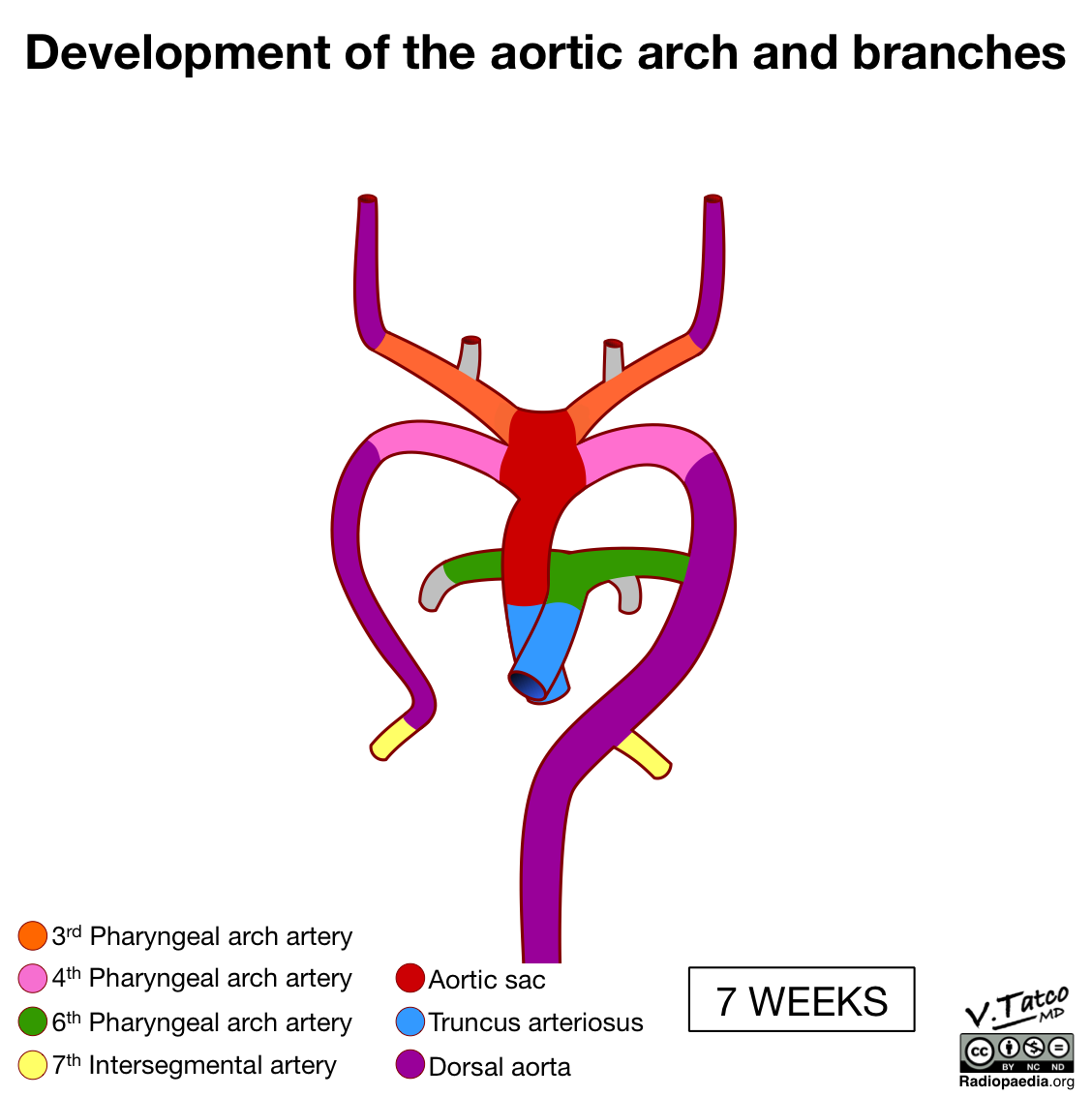 Radiopaedia Drawing Development Of The Aortic Arch And Branches At 7